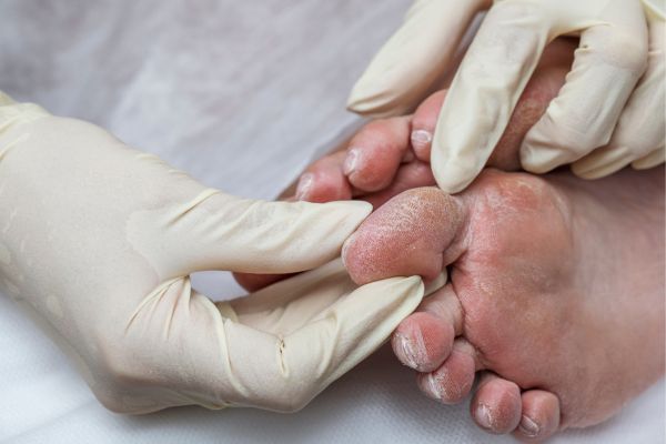 Angebotsbild diabetische Fußpflege